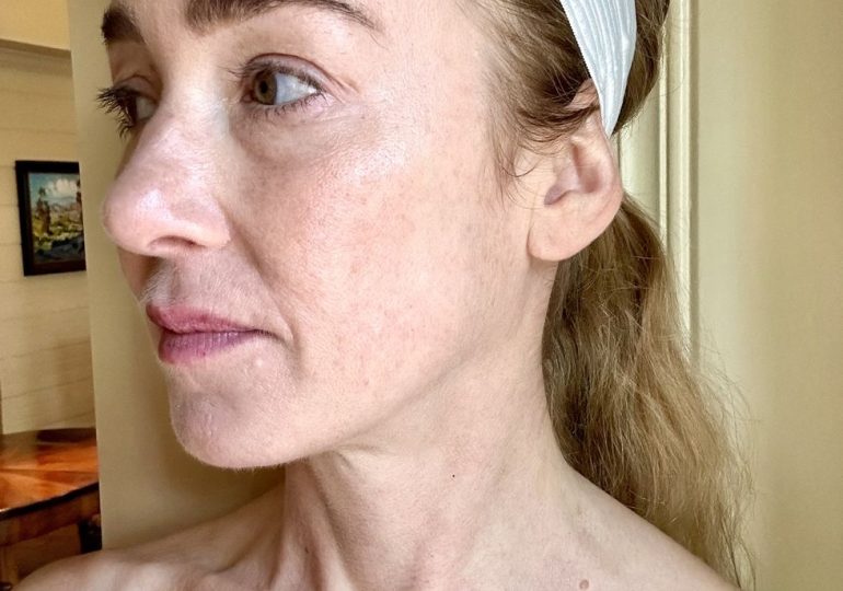 Matrix Is the Skin Tightening Treatment That Turns Back the Clock